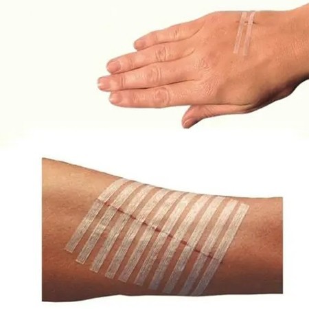 Butterfly Strips
